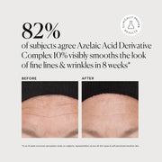 Azelaic Acid Derivative Complex 10% X0