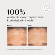 BHA Liquid Exfoliant 2% K8